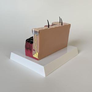 Modello Anatomico di Bruciature Cutanee con Codifica a Colori per Tessuti Normali e Bruciature di Terzo Grado, Modello Didattico per l'Educazione in Dermatologia - Product Image 5