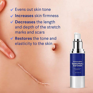 Crema Personalizada con Logotipo de Belleza Orgánica para <span class=keywords><strong>Embarazo</strong></span>, Antiarrugas, Blanqueadora, Suavizante, Hidratante, Elimina Cicatrices y Estrías - Product Image 4