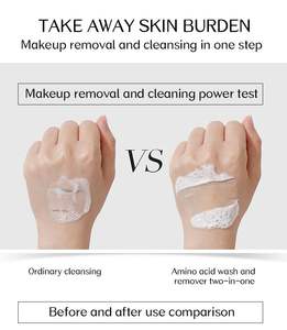 โลโก้ที่กําหนดเองไวท์เทนนิ่ง<span class=keywords><strong>โฟม</strong></span>ขมิ้นกรดซาลิซิลิกผู้ชายสิวน้ําข้าวที่ดีที่สุดสําหรับผู้หญิงสําหรับผิวมันกรดโคจิก<span class=keywords><strong>ล้าง</strong></span><span class=keywords><strong>หน้า</strong></span> - Product Image 2