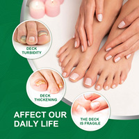 Sérum de traitement fongique des ongles OEM sérum de soin liquide pour la réparation des pieds gel blanchissant pour l'élimination des champignons des ongles des orteils 10ML