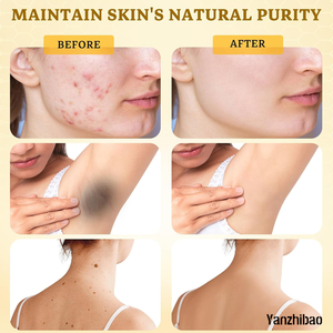 OEM <span class=keywords><strong>Bee</strong></span> <span class=keywords><strong>Venom</strong></span> krim komprehensif perawatan keriput wajah langsung dari Pabrik & pengencang wajah, efektif dalam mengurangi noda kulit - Product Image 5