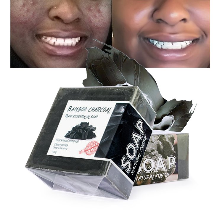 Make Charcoal Soap Natural Effective Bleaching Solutions