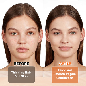 เยลลี่สกัดน้ำมันเมล็ดฟักทองไร้น้ำตาล ยอดขายดี สำหรับบำรุงเส้นผม ต่อมลูกหมาก ภูมิคุ้มกัน และระบบทางเดินปัสสาวะ - Product Image 3