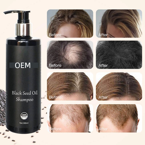 Champú acondicionador orgánico para el crecimiento del cabello, esencia anticaída, aceite de semilla negro Natural, anticaspa, encrespamiento, OEM - Product Image 2