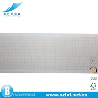 Rollo de Papel Térmico para Ultrasonido de Alta Definición FOISON, Capa Única, 110 mm de Ancho, 18 m de Largo, Certificado ISO9001, UPP-110HG 110S, Uso Médico