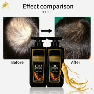 Private Label Prevent Loss and Improves Brittle Hair be Nourishing and Anti-Hair Loss Shampoo for Hair Growth