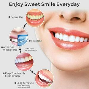 Irrigador Bucal Inalámbrico al por Mayor de Fábrica, Limpiador Dental USB - Product Image 5