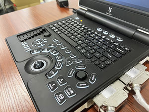 Laptop portabel kinerja tinggi warna pemindai <span class=keywords><strong>Ultrasound</strong></span> Harga instrumen <span class=keywords><strong>Ultrasound</strong></span> medis - Product Image 4