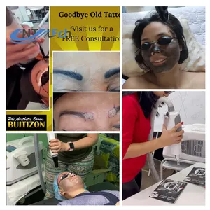 Comprar china preço de promoção picosegundo q comutado ruby nd yag laser máquina de remoção de tatuagem