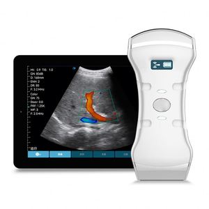Sonde linéaire à ultrasons Doppler couleur sans fil 3 en 1 pour l'abdomen cardiaque Scanner à ultrasons sans fil 3 en 1 - Product Image 1