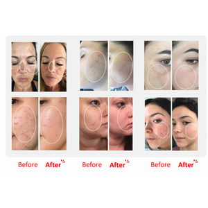 เวลาทอกซ์ GF11 คอลลาเจนเปปไทด์ วิตามินต้านอนุมูลอิสระ สารกระตุ้นการเจริญเติบโตของเซลล์ OEM ODM เซรั่มลดเลือนริ้วรอย ฟื้นฟูผิว - Product Image 6