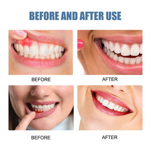 Vendita calda dentifricio prodotto per la cura orale per adulti alito fresco sbiancamento dentale gomma proteggere riparazione SPRAY - Product Image 5