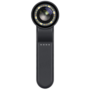 KTMED KT-P088 Instrument Dermatologique <span class=keywords><strong>Dermatoscope</strong></span> Corps Métallique Polarisé et Non Polarisé Dermatoscopio Numérique - Product Image 1