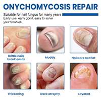 Patchs de réparation rapide et efficace pour les ongles des pieds Ximonth, multi-usages, traitement des ongles incarnés, bandes de traitement des champignons des ongles, patch de correction des ongles des pieds