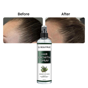 Nhãn Hiệu Riêng Tăng Trưởng Tóc Phun Chuyên sâu Tăng Cường Tăng Trưởng Tăng Cường Thảo Dược Nang Thuốc Bổ Da Đầu Huyết Thanh Cho Dày - Product Image 3