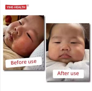 Krim Eksim Bayi MeiZheng 15g, Disetujui Dokter Anak, Herbal Antibakteri, Pereda Gatal Kulit untuk Ruam Panas, Ruam Popok, Plester Cina - Product Image 5