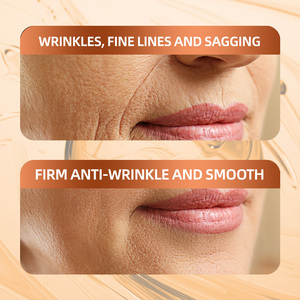 Set di Cura della Pelle 5 Pezzi con Astaxantina e Retinolo Anti-Rughe Rassodante Idratante Etichetta Privata OEM per Donne Bellezza all'Ingrosso - Product Image 6