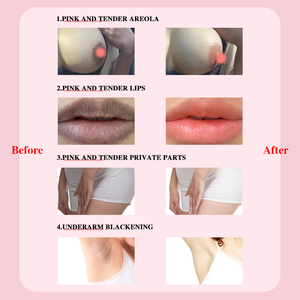 Parte privata <span class=keywords><strong>crema</strong></span> sbiancante per via vaginale essenza capezzolo Areola labbra sbiancamento per la candeggina anale Color rosa <span class=keywords><strong>crema</strong></span> - Product Image 3