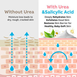 Removedor de callos hidratante profundo de etiqueta privada, <span class=keywords><strong>crema</strong></span> de <span class=keywords><strong>urea</strong></span> 40% para pies, manos y cuerpo para pies más ácido salicílico 2% ácido hialurónico - Product Image 4
