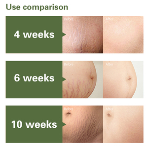 Crème Botanique Anti-Rides et Anti-Vergetures : Sûre pour les Mamans, Absorption Rapide, Lisse et Raffermit Visiblement la <span class=keywords><strong>Peau</strong></span> du Corps. - Product Image 5