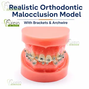 Modelo de Dientes con Maloclusión Ortodóntica, Modelo de Estudio de Desalineación Dental con Bracket y Arco para Entrenamiento de Dentistas y Educación del Paciente - Product Image 2