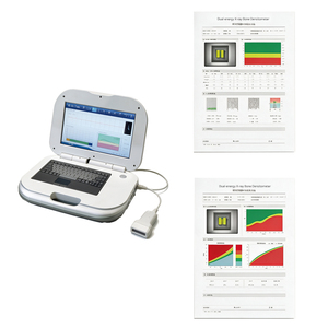 Densitomètre osseux à ultrasons, testeur portable de densité minérale <span class=keywords><strong>osseuse</strong></span>, analyseur BMD pour la détection <span class=keywords><strong>osseuse</strong></span> humaine - Product Image 4