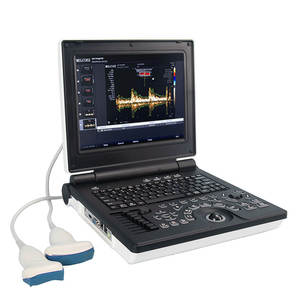 Mesin <span class=keywords><strong>Ultrasound</strong></span> Doppler warna <span class=keywords><strong>Laptop</strong></span> harga murah - Product Image 1