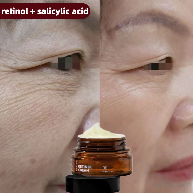 Crème anti-rides au rétinol