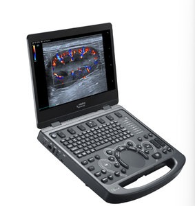 Système d'échographie vétérinaire portable d'entrée de gamme Mindray Vetus E3, classe II, certifié CE, garantie d'un an - Product Image 3