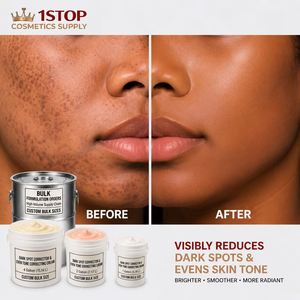 <span class=keywords><strong>Crema</strong></span> Antipecas, <span class=keywords><strong>Crema</strong></span> Facial Aclarante, <span class=keywords><strong>Crema</strong></span> Blanqueadora de Piel, Incubación de Marca de Belleza Integral de Fábrica - Product Image 1