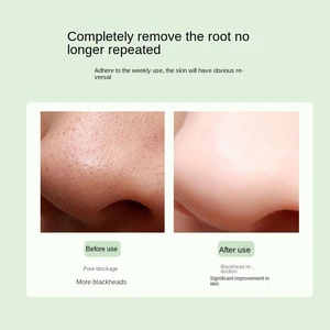 Visual Cleansing ABS Waterproof <b>Handheld</b> <b>Vacuum</b> Adsorption Facial Pore Cleaning Acne Deep Suction Beauty Instrument Home Use - Product Image 3