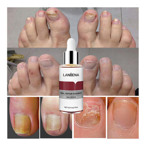 Lanbena – Essence de réparation d'ongles, adoucissant, traitement contre les champignons des ongles, Protection nourrissante, sérum de réparation d'ongles avec petite lime 12ml - Product Image 4
