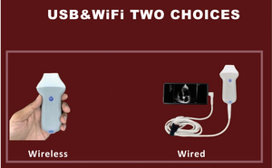 कोटेड एमडीआर उच्च गुणवत्ता वाले चिकित्सा अल्ट्रासाउंड उपकरण रंग डॉपलर वायरलेस और यूएसबी चरणबद्ध सरणी जांच - Product Image 6