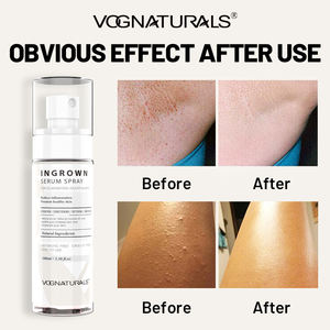 เซรั่มสเปรย์<span class=keywords><strong>ก</strong></span>ำจัด<span class=keywords><strong>ขน</strong></span>คุด OEM ODM สูตรธรรมชาติ สำหรับขา รั<span class=keywords><strong>ก</strong></span>แร้ และบริเวณบิกินี่ - Product Image 3