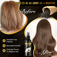 Sérum en Spray para el Crecimiento del Cabello con Biotina y Agua de Arroz Negro, Tratamiento de Crecimiento Rápido para la Caída del Cabello para Hombres y Mujeres, 100 ml