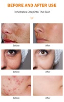 Huile de curcuma biologique pour le visage et le corps, blanchiment naturel, élimination des taches brunes, huile de massage hydratante, éclaircissement de la peau