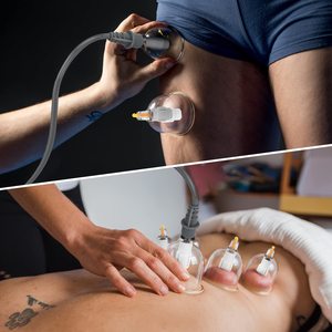 Kit de ventouses faciales sous vide 32 pièces pour thérapie Hijama et massage, idéal pour le dropshipping et les marques privées FBA - Product Image 3