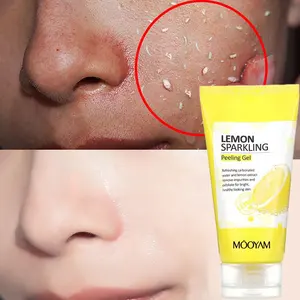 Özel etiket Peeling limon köpüklü soyma jeli ölü cilt kaldırma doğal derin Exfoliator fırçalama temizleme soyma jeli