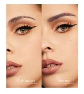 Irect-Juego de agujas de acero inoxidable, juego de 5 olores - Product Image 6