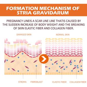 ครีมรักษารอยแตกลายสำหรับผิว 100% ออร์แกนิค สำหรับคนตั้งครรภ์ - Product Image 4