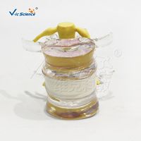 Modelo de demostración de hernia de disco lumbar modelo de articulación anatómica de esqueleto humano para ciencia médica