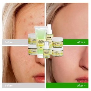 Low MOQ Organic Skin Care Set Tea <strong>Tree</strong> <strong>Face</strong> Cream Remove Anti Acne Shrink Pores Tea <strong>Tree</strong> <strong>Face</strong> Care Set Tea <strong>Tree</strong> Facial Kit - Product Image 2