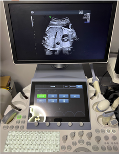 Fourniture et réparation de la machine à ultrasons VoLuson E8 - Product Image 6