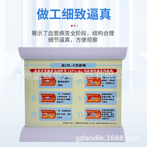 Modèle de simulation vasculaire d'occlusion et d'hyperlipidémie ; dynamiques pathologiques de l'athérosclérose et de la thrombose artérielle ; - Product Image 1