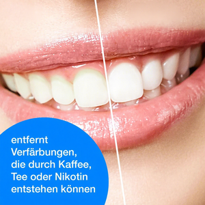 Soin <span class=keywords><strong>dentaire</strong></span>, pâte à polir pratique pour éliminer les taches et le tartre avec de l'hydroxyapatite, 10g - Product Image 6
