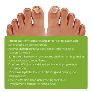 Kit de pédicure pour onychomycose des pieds West Month 100% naturel, 6 pièces, gingembre, bain de pieds antifongique - Product Image 3