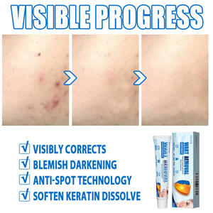 2025 nuevo extracto de hierbas Keyou bálsamo específicamente para la limpieza profunda de la cara crema limpia nutritiva cuidado del cuerpo - Product Image 3