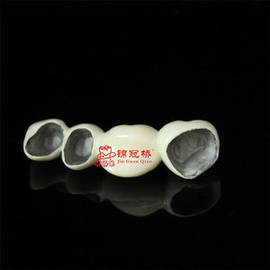 Apariencia Natural Impresión 3D Pfm Co-Cr Aleación Metal Cerámica Coronas dentales fijas comunes Puente Implantes Dentaduras postizas - Product Image 4