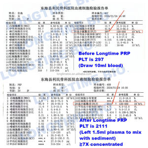 พลาสม่าที่อุดมไปด้วยเกล็ดเลือดทางการแพทย์สำหรับเยื่อบุโพรงมดลูกอักเสบ - Product Image 6