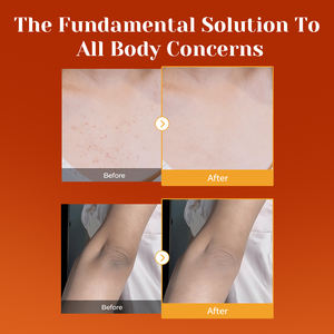 Spray exfoliant corporel à l'acide kojique et au curcuma pour le soin de la kératine, solution exfoliante douce pour éclaircir et unifier le teint - Product Image 5